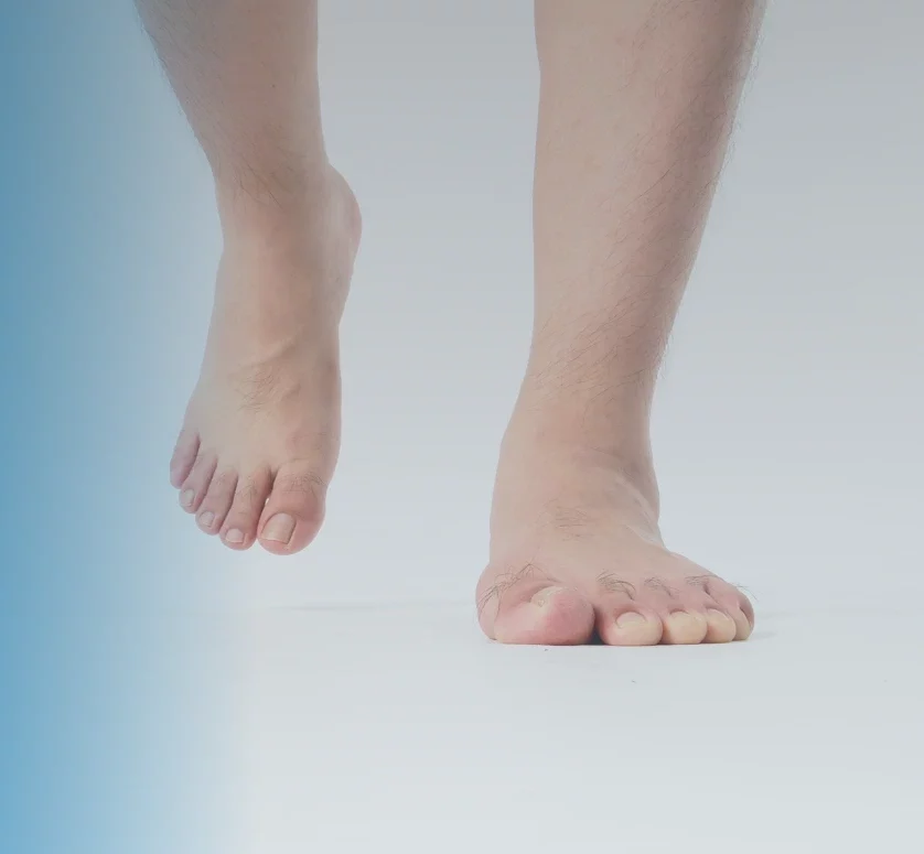 Flat Feet Treatment In Surfside, FL Banner