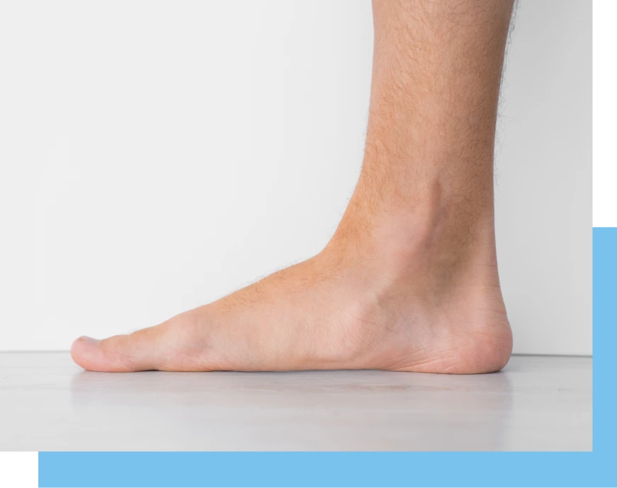 Your Initial Appointment For Flatfoot Correction In Surfside, FL Banner