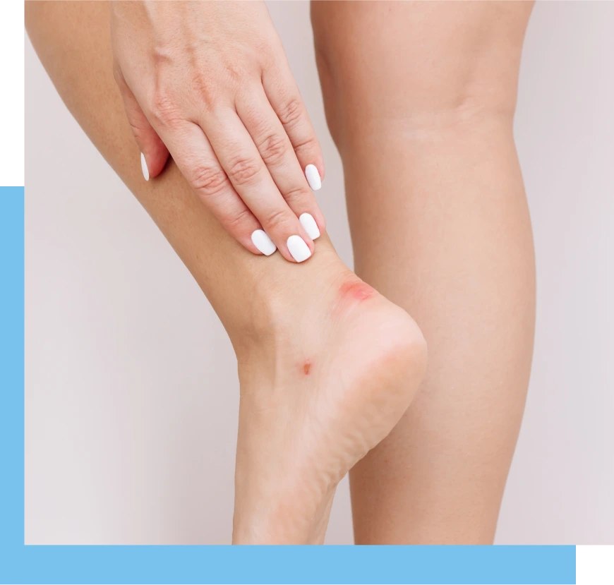 Causes of Foot Wounds Bal Harbour, FL Banner