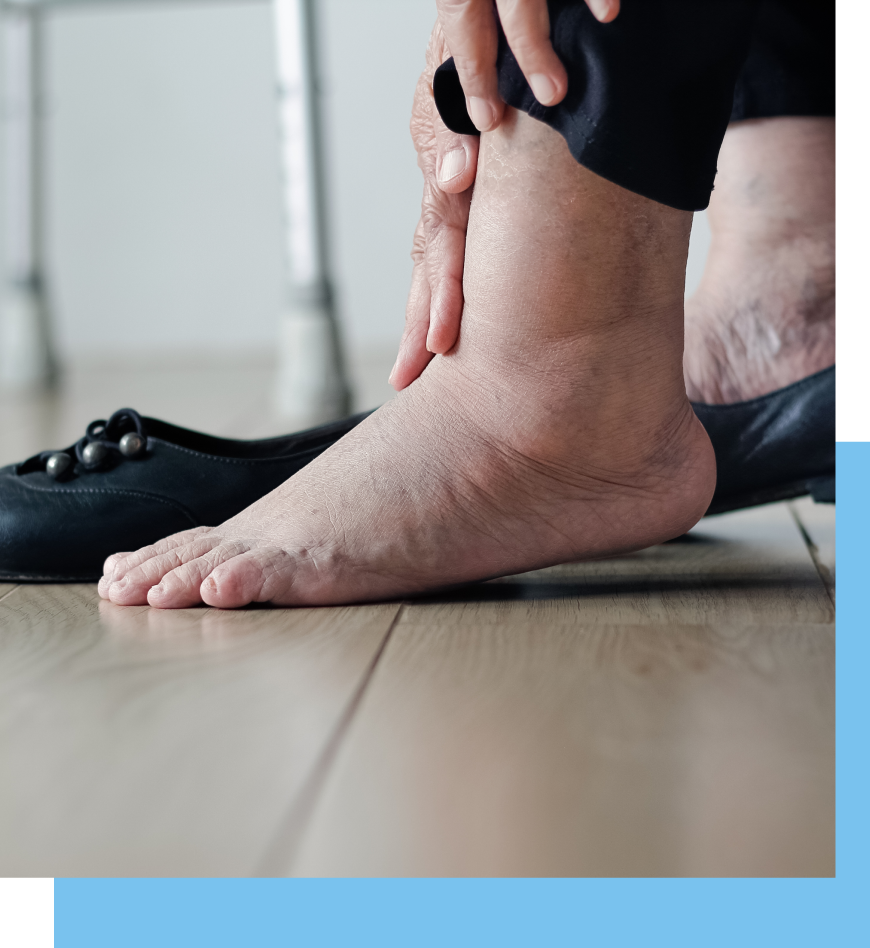 Diabetic Foot Care in Surfside, Florida Banner