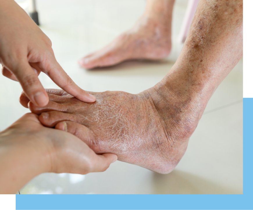 Diabetic Foot Treatment in Surfside, FL Banner